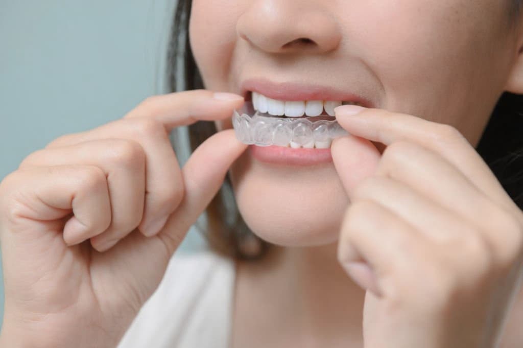 Invisalign treatment at Capitol Smiles Dental in Trenton